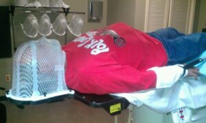 Champ receiving radiation